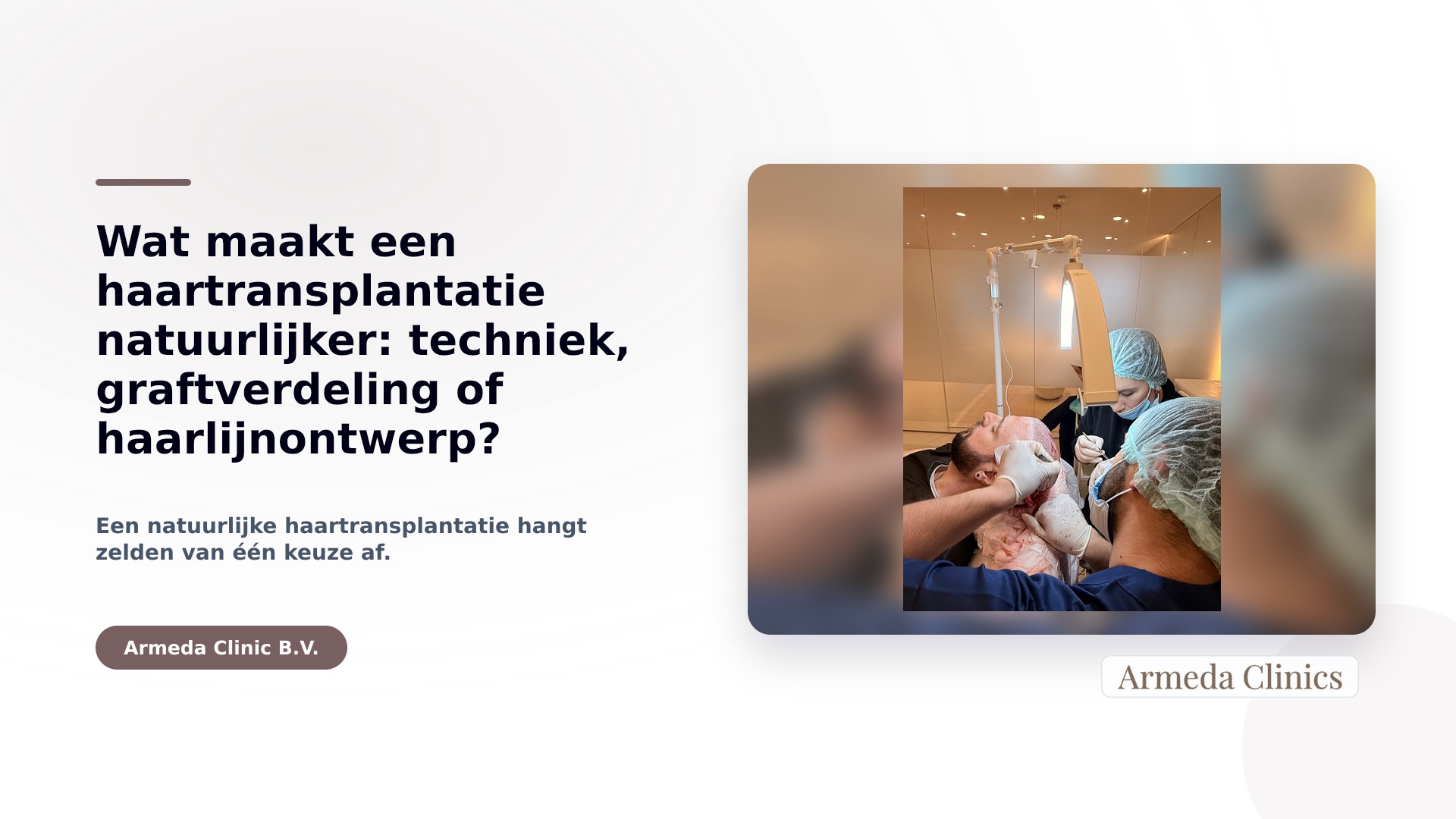 Wat maakt een haartransplantatie natuurlijker: techniek, graftverdeling of haarlijnontwerp?