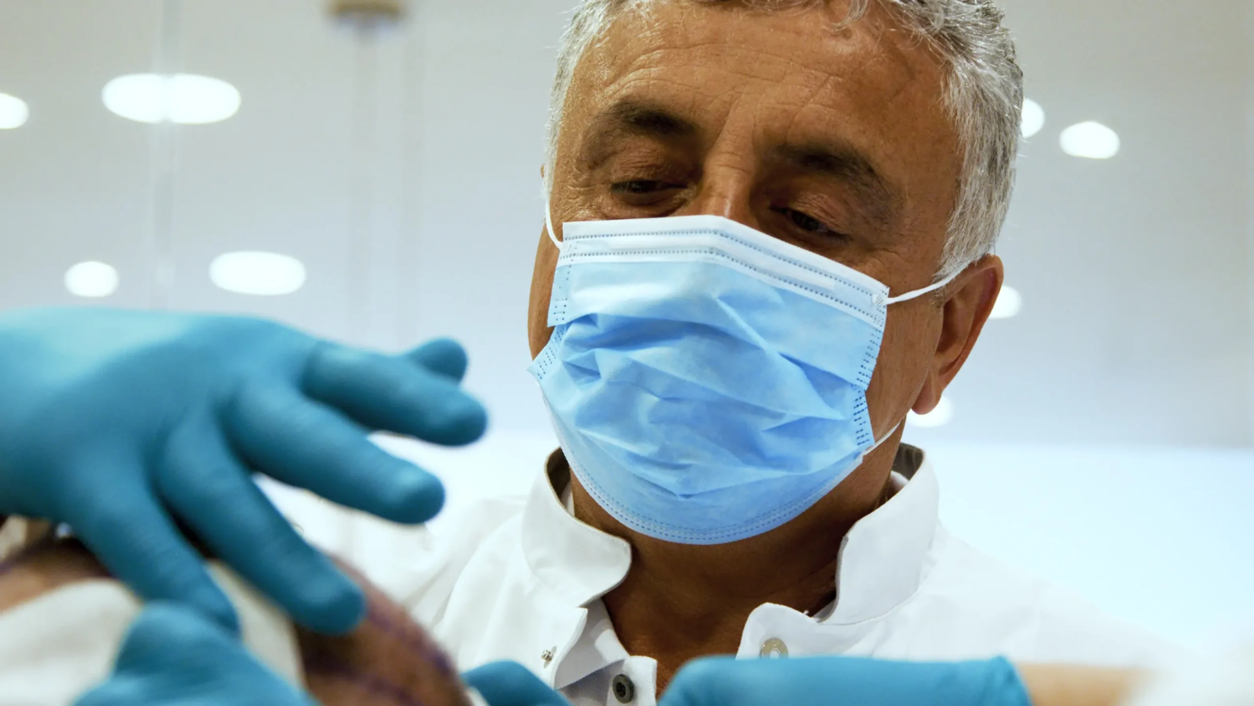 Close-up van een specialist bij een haartransplantatie behandeling Armeda Clinics in Eindhoven