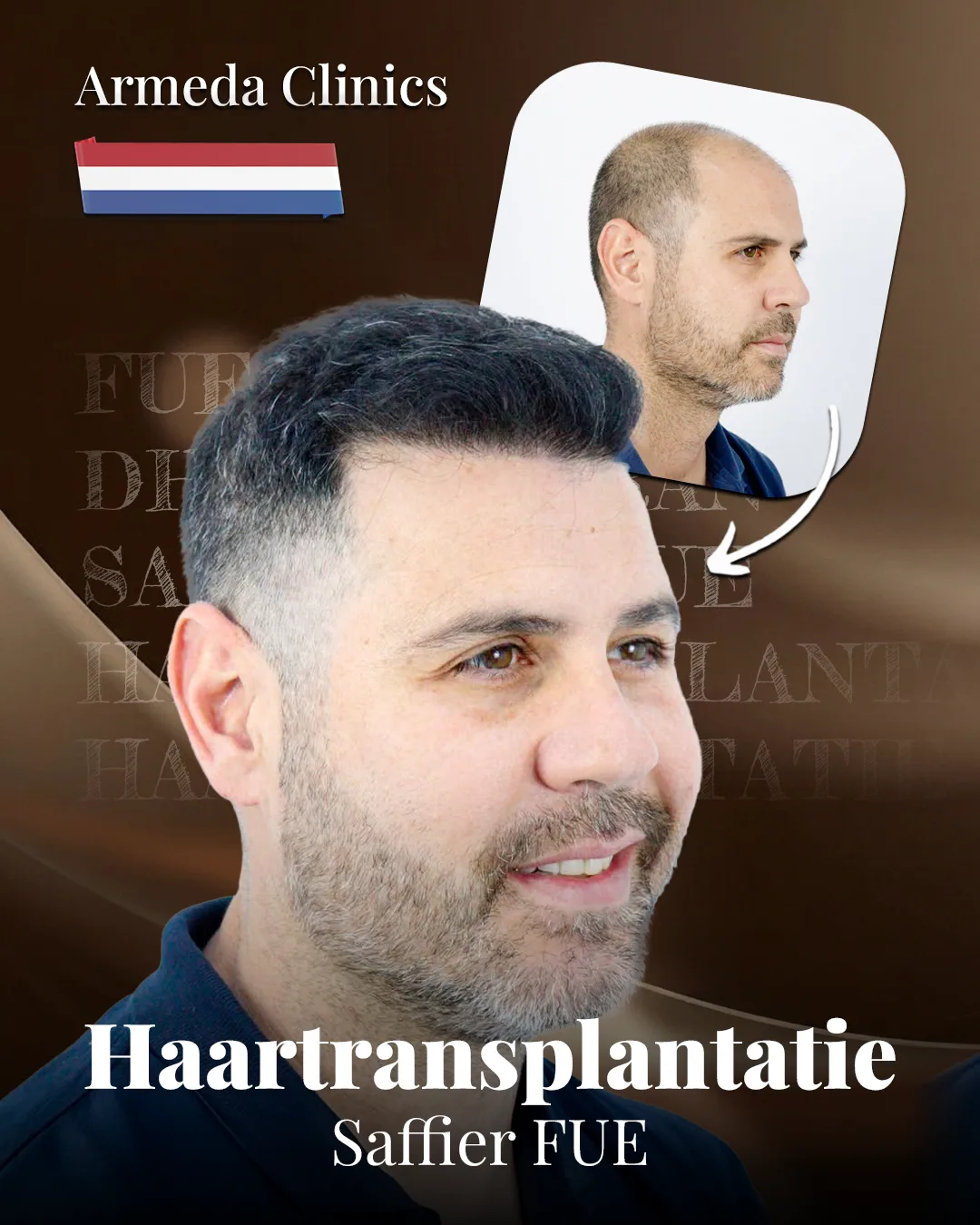 Situatie voor en na de behandeling naast elkaar