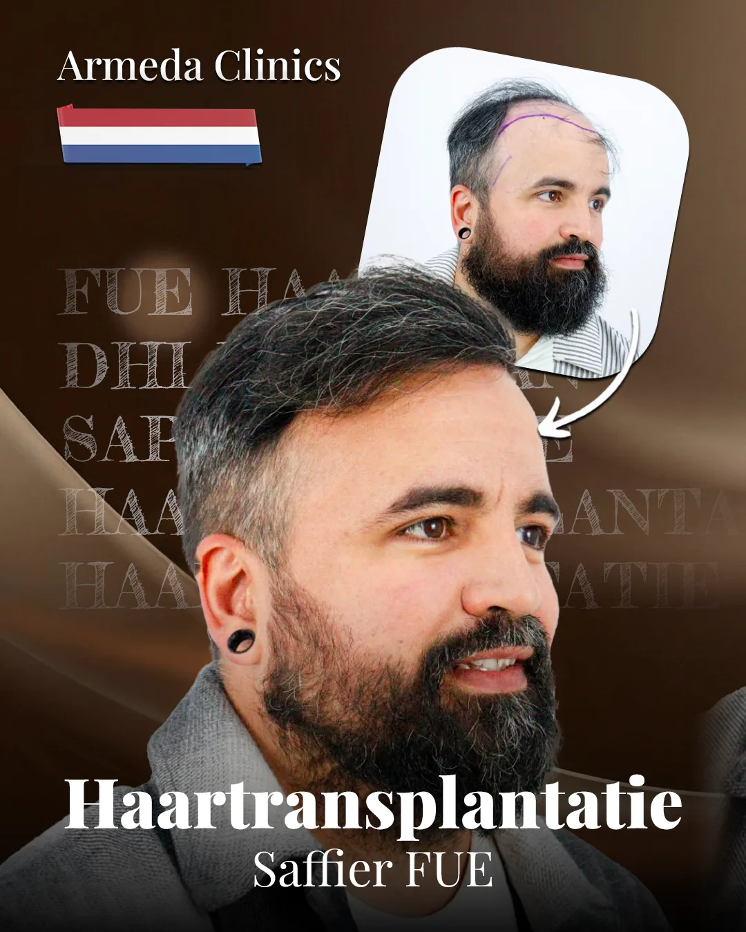 Situatie voor en na de behandeling naast elkaar