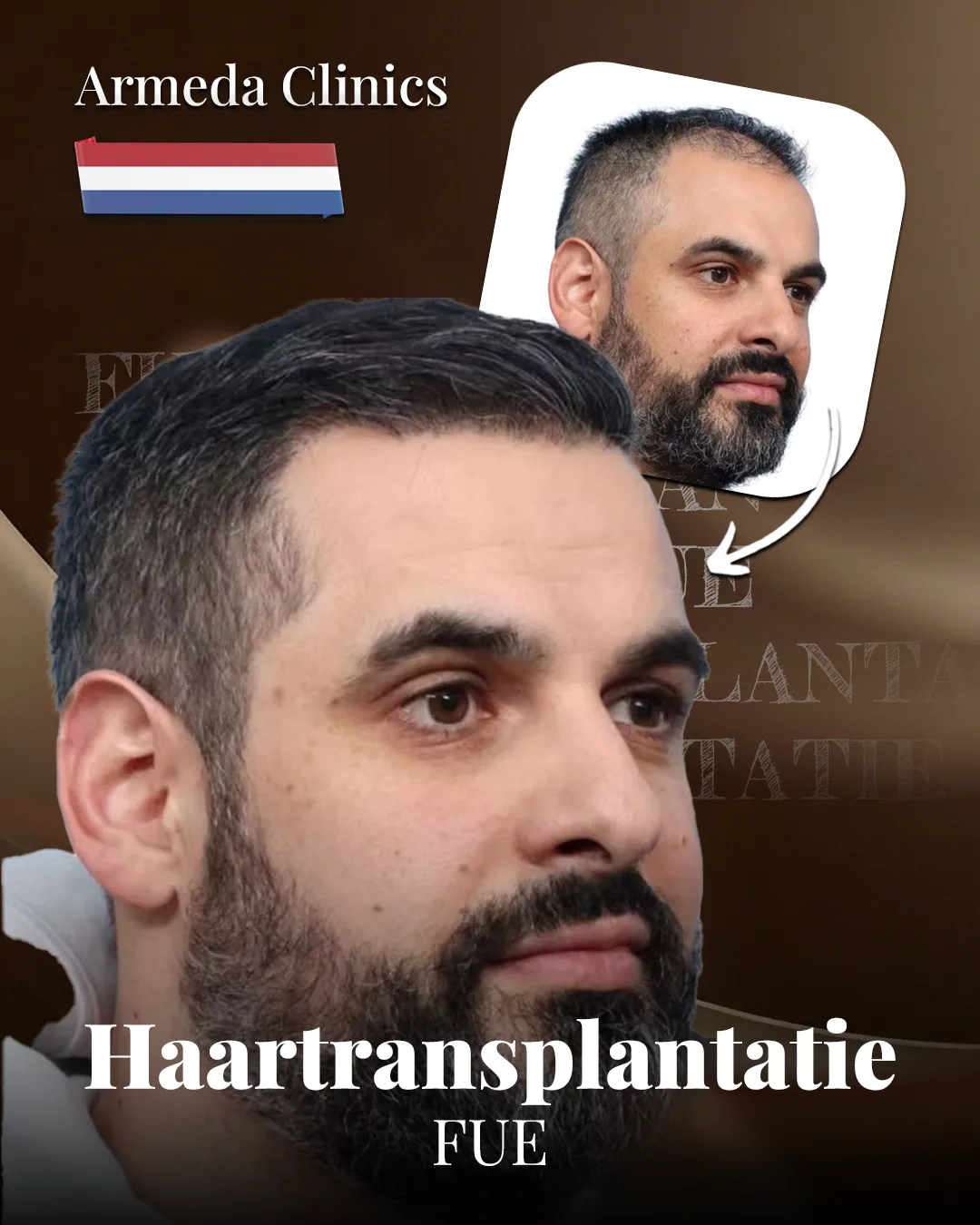 Situatie voor en na de behandeling naast elkaar
