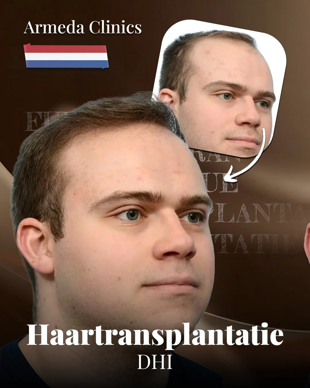 Situatie voor en na de behandeling naast elkaar
