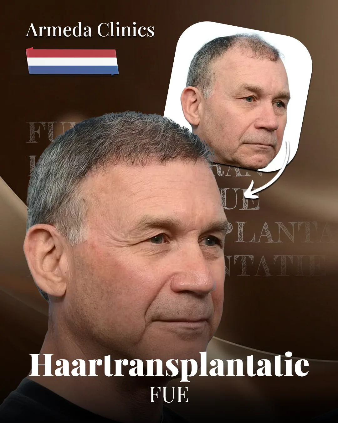 Situatie voor en na de behandeling naast elkaar